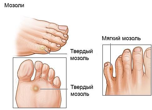 Проекция органов на ступне